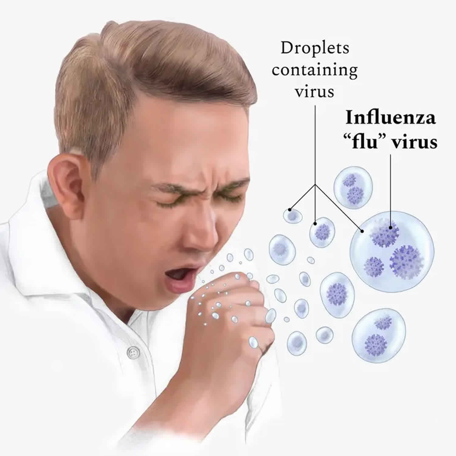 Influenza Flu Causes Symptoms Vaccine Diagnosis Treatment