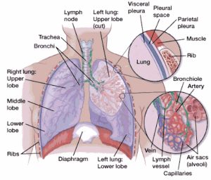 Spontaneous pneumothorax causes, signs, symptoms, diagnosis & treatment