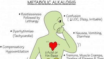 metabolic alkalosis