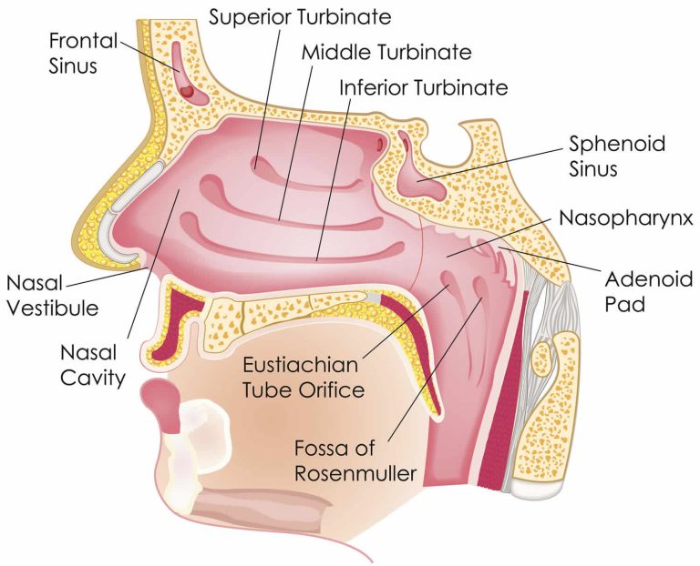 Congenital pyriform aperture stenosis causes, symptoms, diagnosis ...