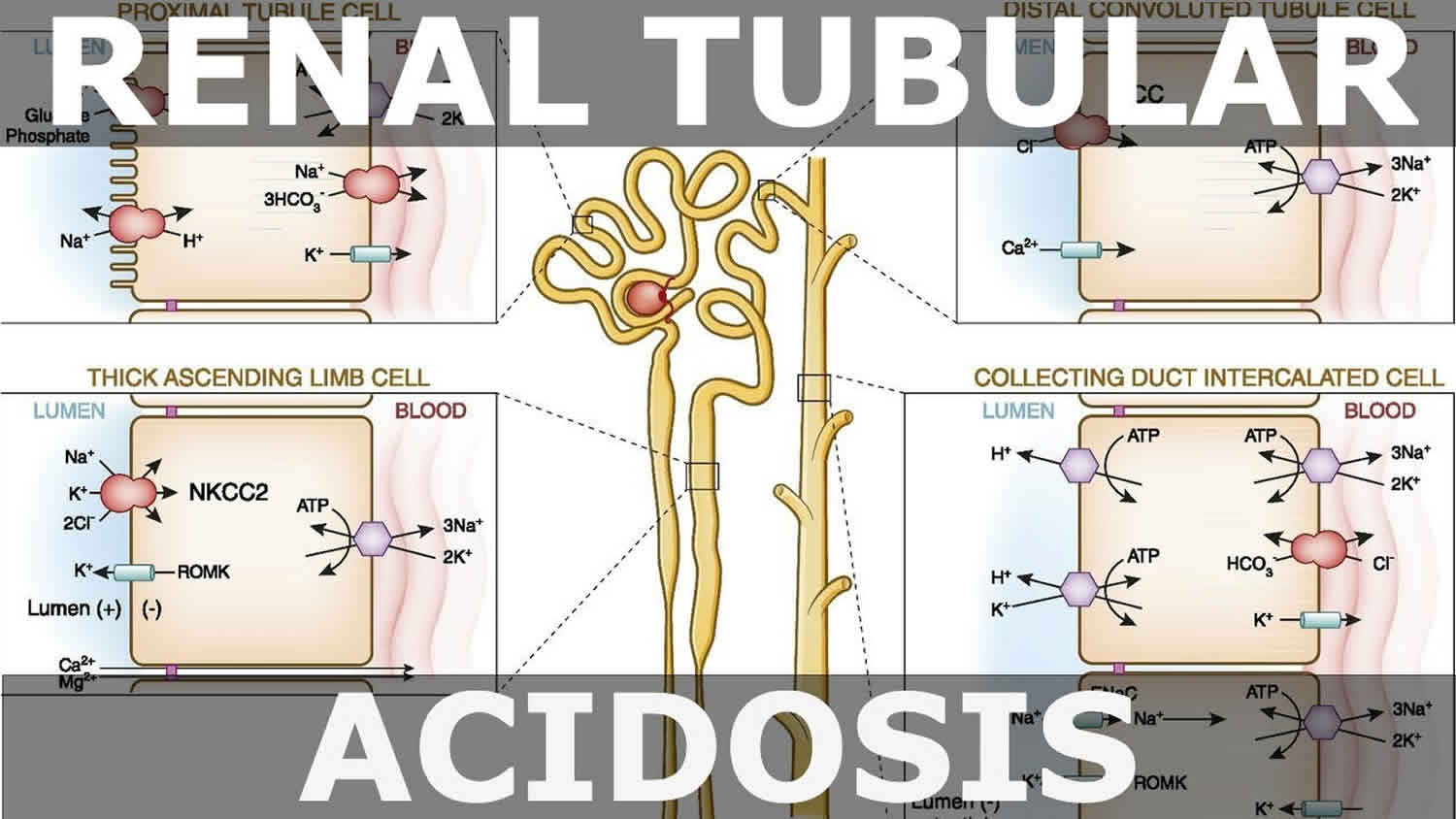 renal tubular acidosis