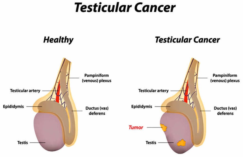 Testicular Self Exam How To Perform Testicle Self Check For Cancer