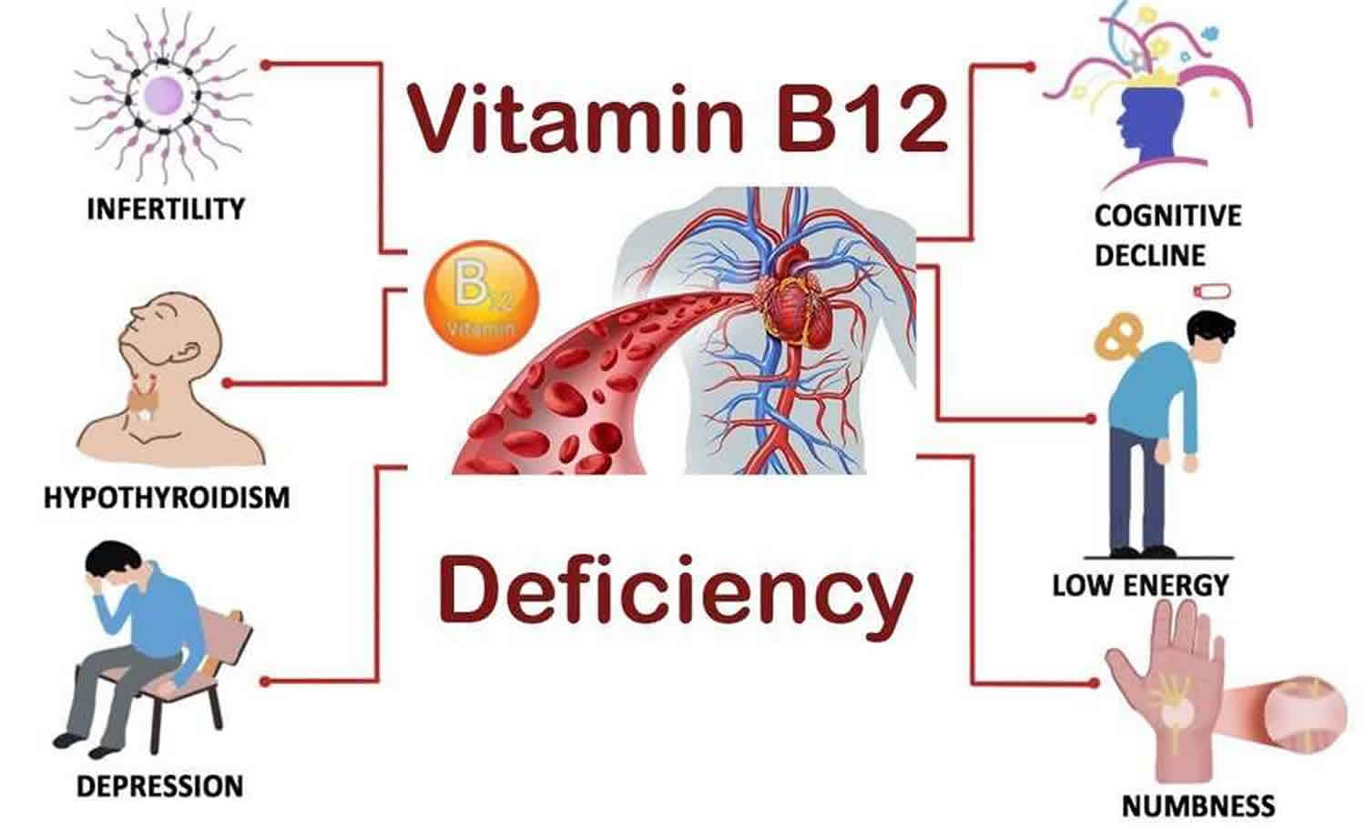 Vitamin B12 Deficiency, Causes, Signs, Symptoms, Diagnosis, Treatment ...