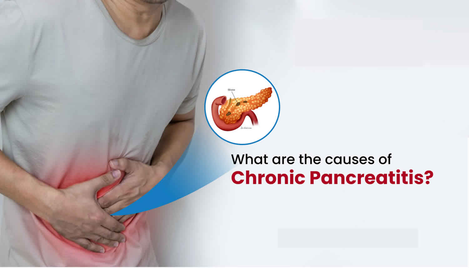 Chronic pancreatitis, causes, symptoms, diagnosis, treatment & prognosis
