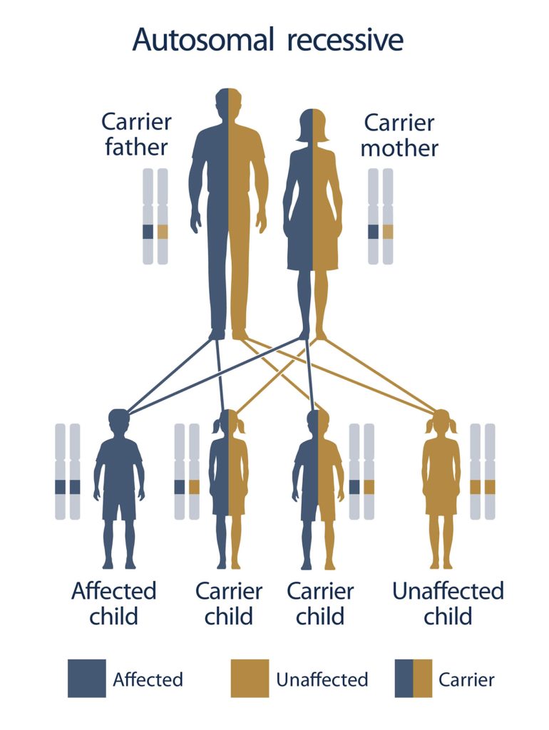 Congenital Adrenal Hyperplasia, Causes, Signs, Symptoms, Diagnosis ...