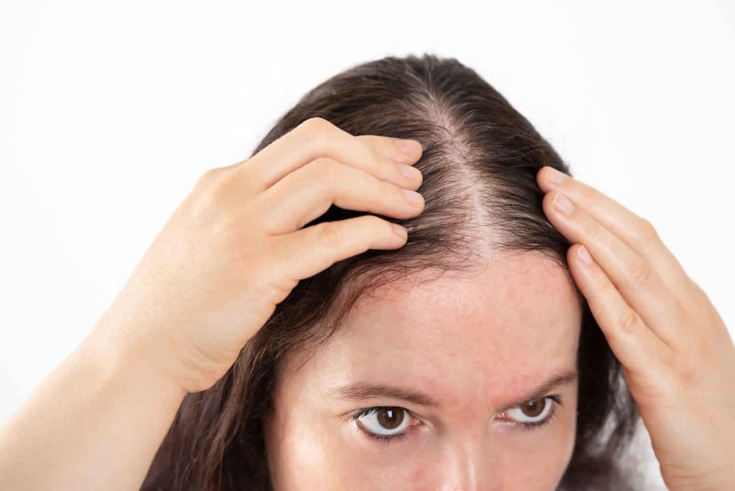 Thinning hair & female hair loss causes, prevention, diagnosis & treatment