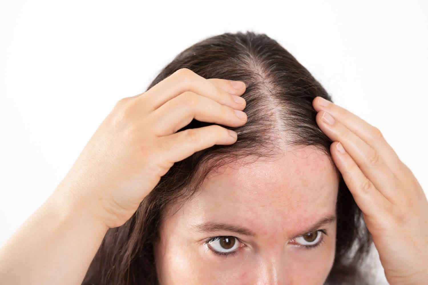 Thinning Hair Female Hair Loss Causes Prevention Diagnosis Treatment