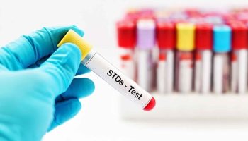 STD testing