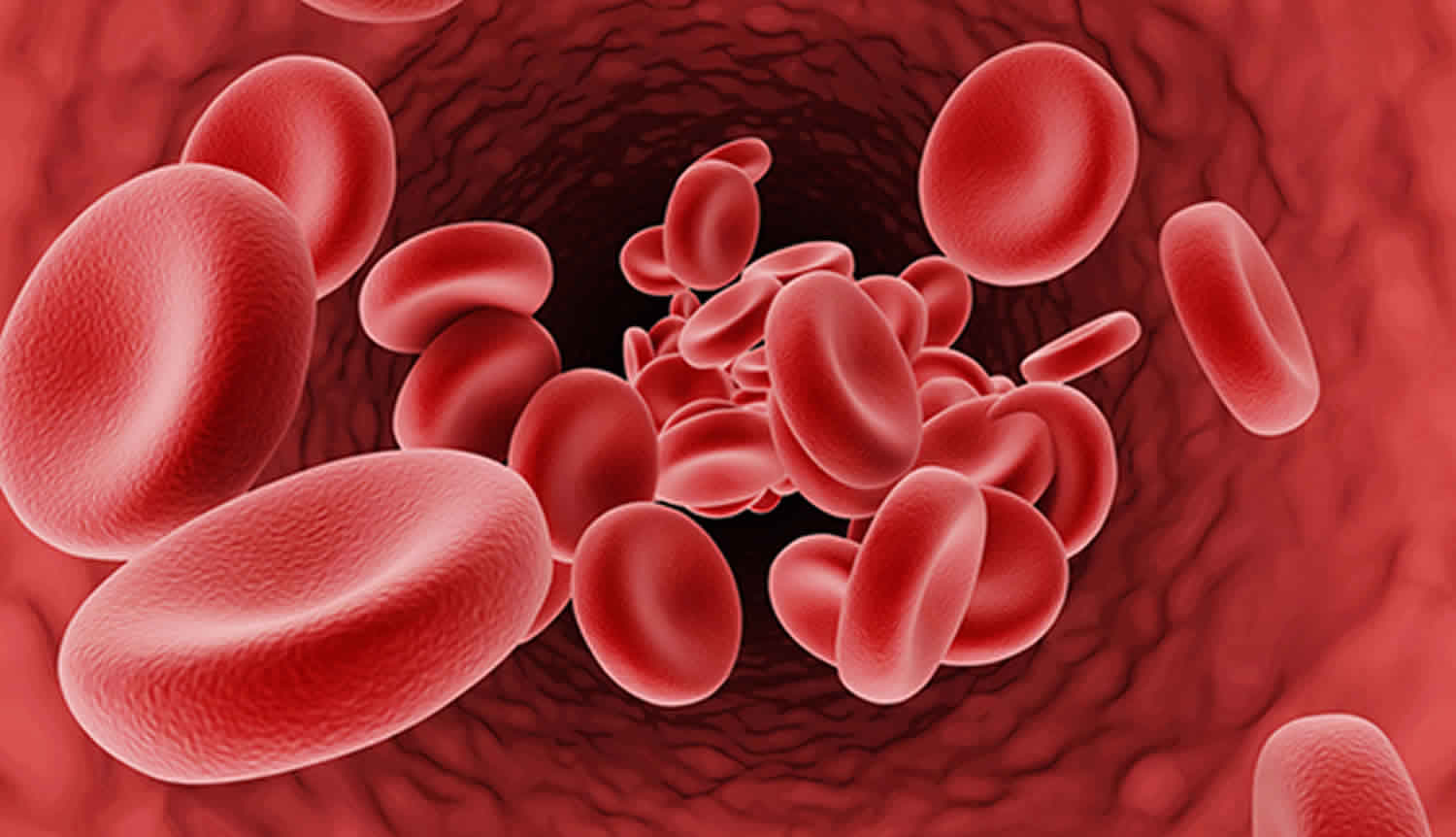beta-thalassemia