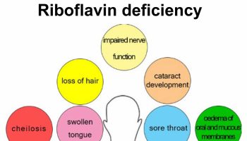 riboflavin deficiency