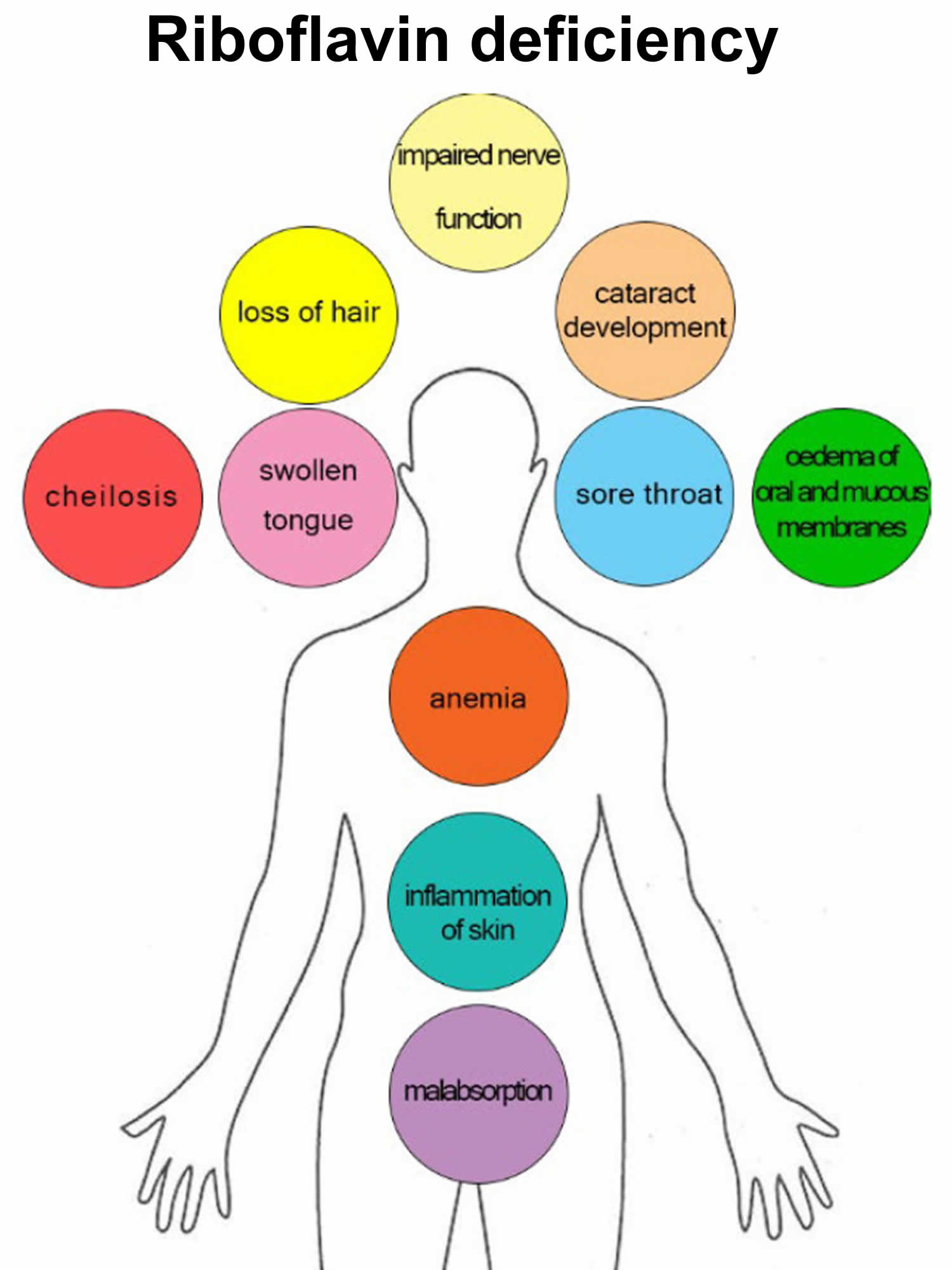 Riboflavin Deficiency Causes Signs Symptoms Diagnosis Treatment