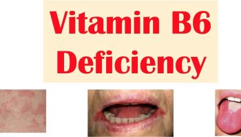 vitamin B6 deficiency