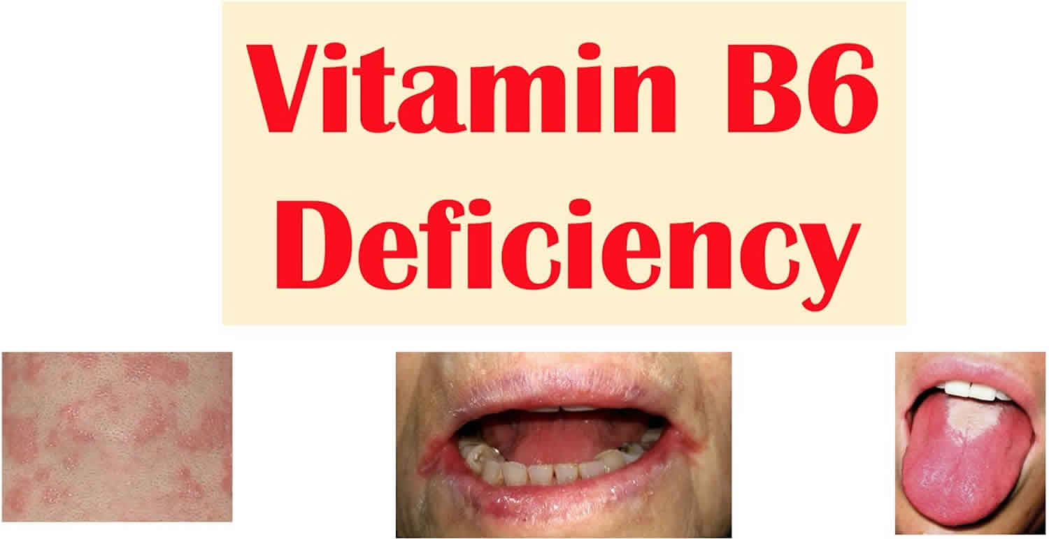 vitamin B6 deficiency