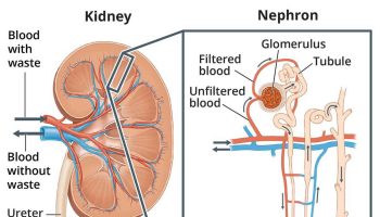 glomerular disease