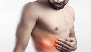 Slipping rib syndrome