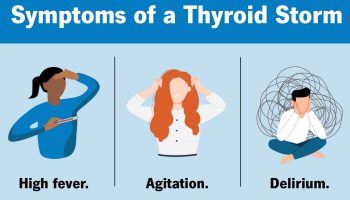 Thyrotoxic crisis